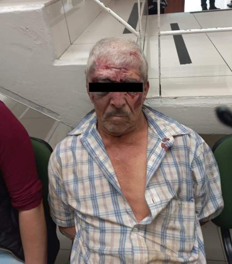 Señor de 83 años mata a policía de tránsito en Naucalpan