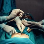 cnne-1328142-cuales-son-las-cirugias-esteticas-mas-populares-en-el-mundo