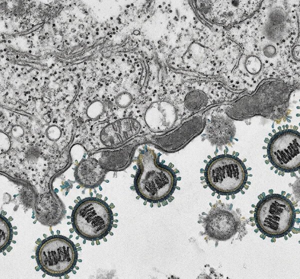 México emite aviso epidemiológico por brote internacional de hantavirus; descartan casos en el país