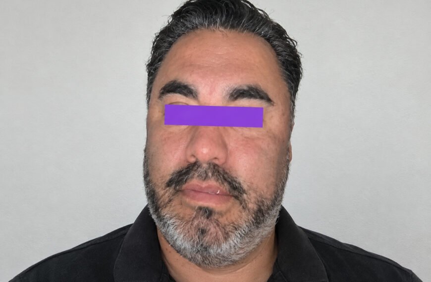 Lo capturan por delitos contra la salud, pero era buscado por homicidio